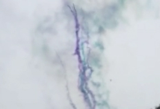 ܽ؟1